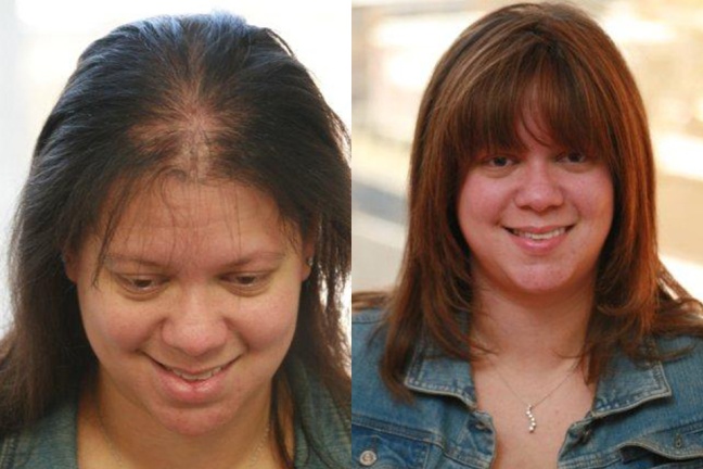 arlene-before-and-after